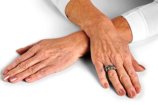 جلد اليد مع التغيرات المرتبطة بالعمر والتي تتطلب استخدام تقنيات التجديد